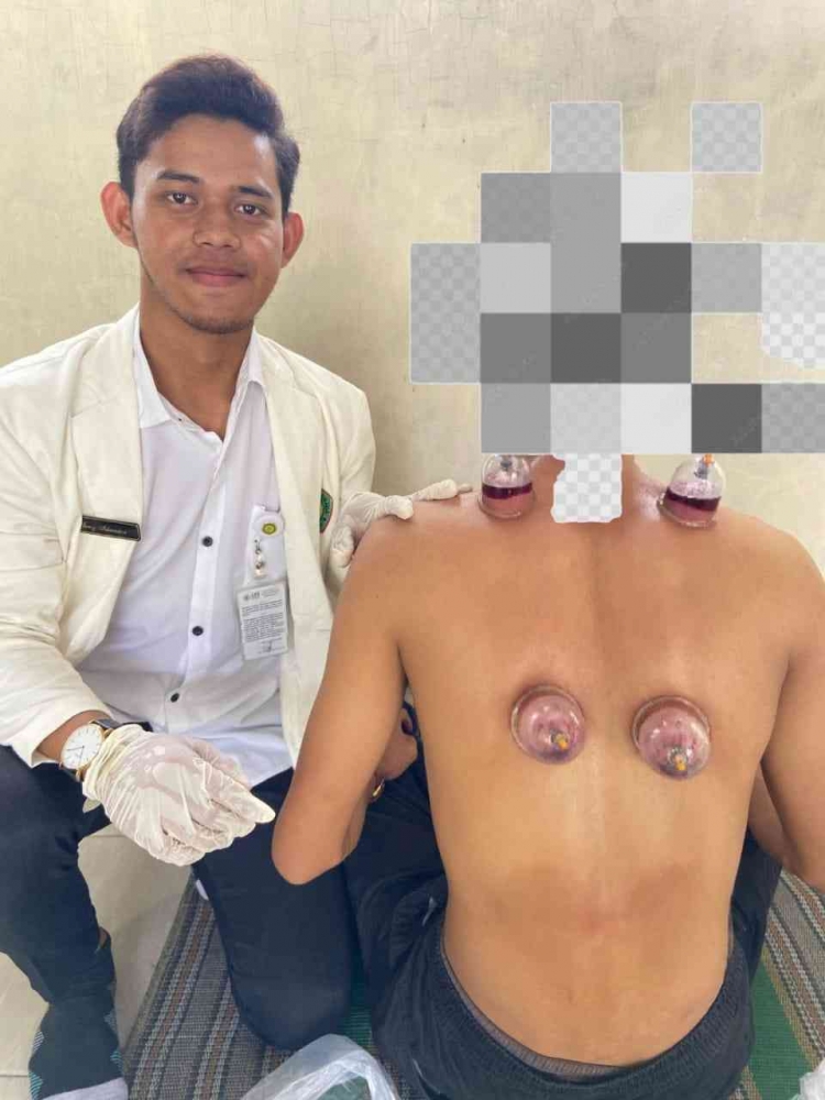 Mahasiswa UNKAHA Terapkan Terapi Bekam untuk Atasi Kolesterol Tinggi di Demak
